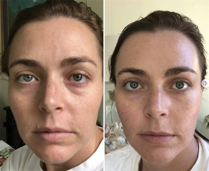 Amanda K. — before and after